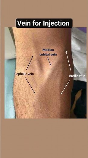 Arm Veins Explained: Median Cubital, Cephalic & Basilic Veins 💉