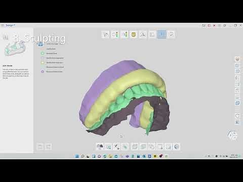 Design bite-splint with Medit Link