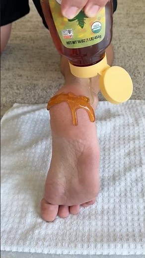 The viral honey hack for cracked heels #beautyhacks #naturalremedies #diy