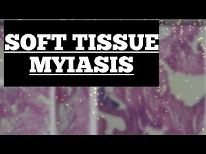 Soft tissue Myiasis || Maggot || Simplified explanation || Images & Histopathology