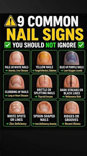 9 common nail signs that you should not ignore