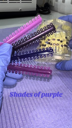 Lavender Braces and Veneers: Pick Your Favorite Shade of Purple at Catli Dental Clinic