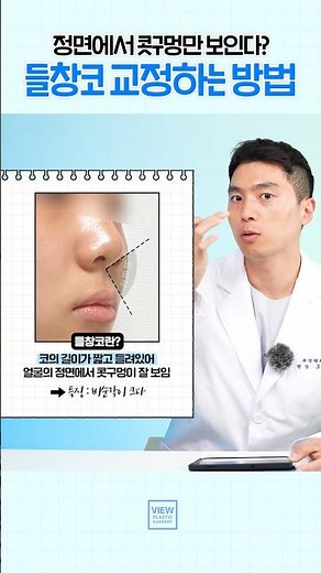[코성형] 사람들이 제 콧구멍만 쳐다봐요ㅠ 들창코 교정하는 방법