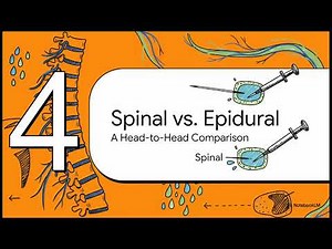 7.2 English. Ch 45. Neuraxial Anesthesia .Morgan and Mikhail Anaesthesia
