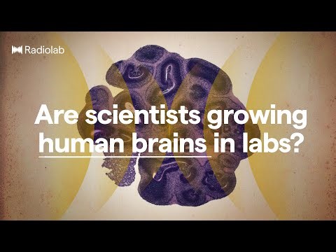 Brain Balls | Radiolab Podcast