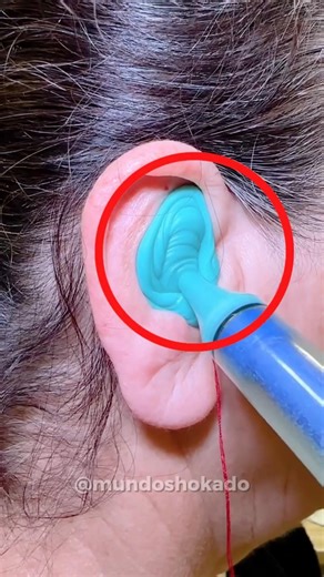 Olha isso dentro do ouvido dela... 😱 #curiosidades