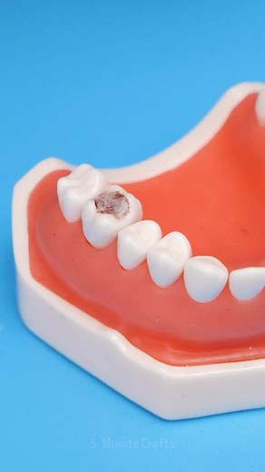 147K views · 286 reactions | POV: A Day in the Life of a Dentist | 5-Minute Crafts Green | Facebook