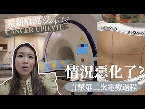 [Cancer Update- Day 552] CT SCAN 結果! ？腫瘤￼情況￼如何?直擊第二次電療過程!