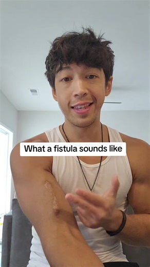Understanding Fistulas: Sounds and Sensations Explained