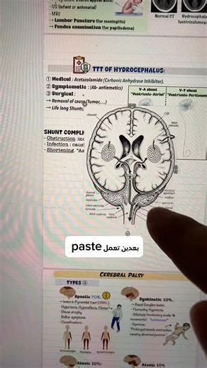 ازاي تطلع ملخصاتك بالكل ده 🎨 # #apps #xdesign #studygram | Anas Wafy