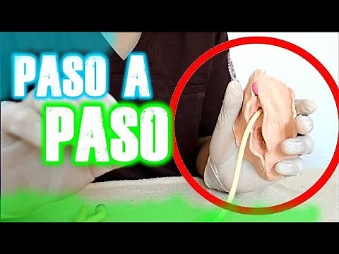 COLOCACION Y FIJACION DE SONDA VESICAL