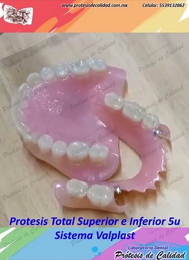 C0001: Prótesis Valplast