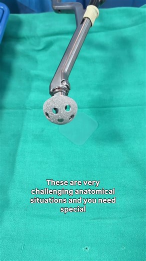 BATMAN SURGERY CUP #hipdysplasia #drpankajwalecha #totalhipreplacement