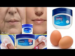 Remove Wrinkles From Face Naturally at Home / Get Rid of Deep Mouth Wrinkles using Vaseline and Egg