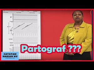 How to Use a Partograph-Bagaimana menggunakan lembar partograf, yuk belajar bersama