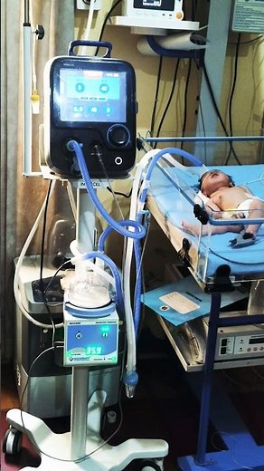 ⭐ Newborn Baby on CPAP Support 😢 | Critical Condition Just After 🥰😘 Birth#NewbornBaby #CPAPMachine