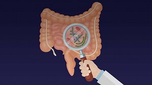 Assessing the Availability of H. Pylori Testing