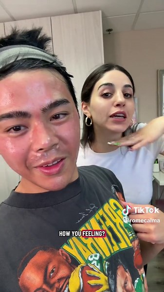 I need to make sure my face looks good for the wedding day! Still couldn’t believe my face got that red! such an amazing experience! ❤️ @westempireaesthetics #mlm #microneedling #gaycouple #fyp #relationships