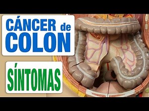 Cáncer de Colon - Síntomas