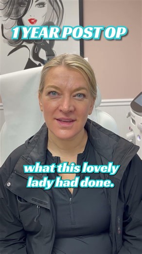 SCAR REVISION JOURNEY after 4 YEARS! #cosmeticsurgery