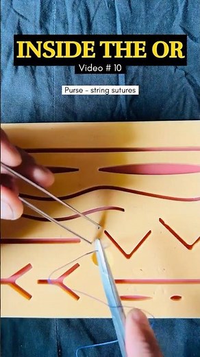 🎥 Mastering the Purse - String suture | Circular wound closure| under 1 min !