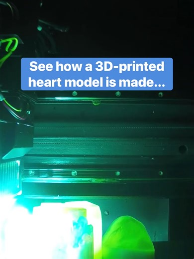 Serving as an exact replica of a patient’s heart, 3D-printed heart models help surgeons plan for complex procedures. Here’s a behind-the-scenes look at how one’s created. #LoveYourHeart 🫀