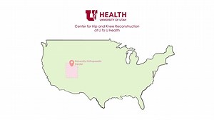 Joint Replacement: Hip & Knee