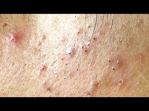 Relax Every Day With Sac Dep Spa #0226