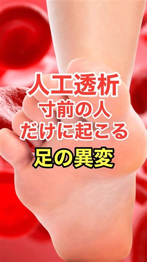Foot Abnormalities That Only Occur in People on the Verge of Dialysis