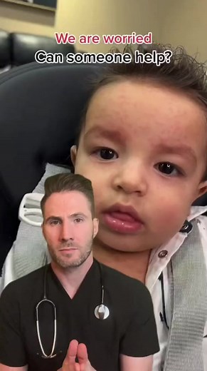 6.9K views · 61 reactions | Amoxicillin rash vs allergy with . Video via #amoxicillin #amoxicillinallergy #firsttimemom #newparents #doctor #allergy #babyallergies | Mary Johnson | Facebook