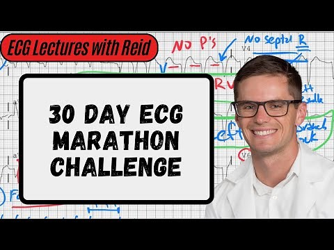 Normal Sinus Rhythm | Day 1 ECG Challenge