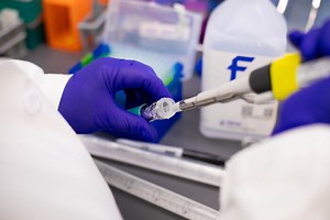 Study Discovers Novel Biomarker for Vascular Aging and Neurodegeneration - News Center