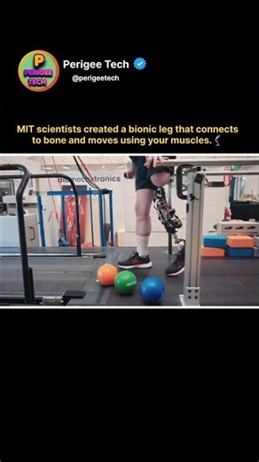 MIT’s Bionic Leg That Moves Like a Real One 🥶 #shorts #bionics #prosthetics #innovation #robotics