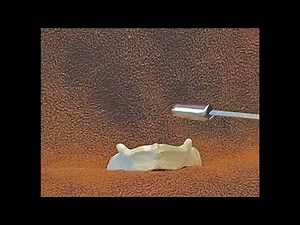 Identification of the Hyoid Bone