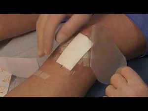 How to Apply Dressing After Knee Surgery | Knee Arthroscopy Post-Operative Care • Video • MEDtube.net