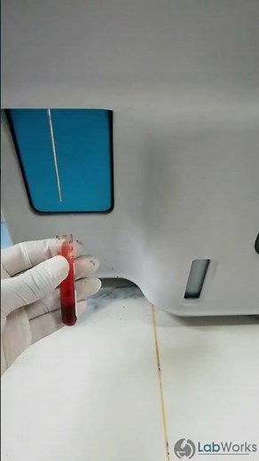 Performing CBC (Complete Blood Count) On Sysmex XP100 3 Part Hematology Analyser #shorts