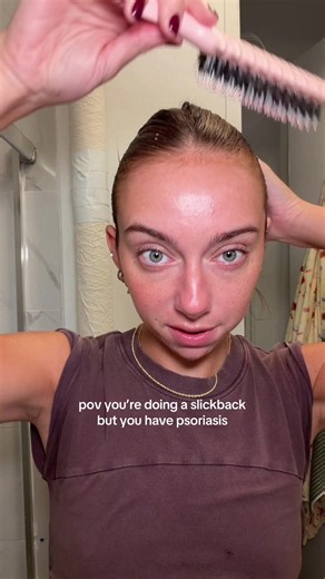 Slickback bun with scalp psoriasis: quick tutorial and tips