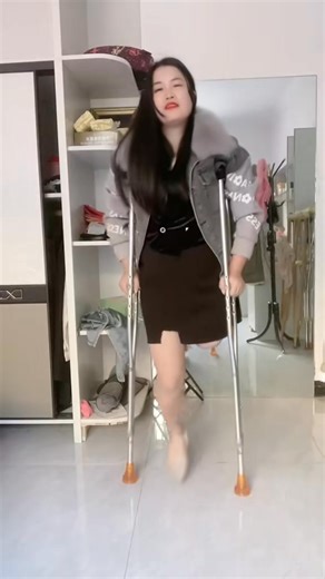 2.7K views · 100 reactions | Dalila amazing SAK amputee： www.amputeeclub.com #amputee #sak #sakam. | Kilponga12 | Facebook