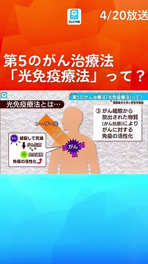 第5のがん治療法と呼ばれる「光免疫療法」の、世界初となる専門研究所が大阪の関西医科大学に誕生しました。身体への負担が少なく、がんに対する免疫力が向上するため再発防止効果も期待されていて、今後、この研究所から様々ながん治療に活用できるよう研究が本格化します。#第5のがん治療 #光免疫療法 #光免疫医学研究所 #関西医科大学 #小林久隆#tiktokでニュース #やさしいニュース #テレビ大阪