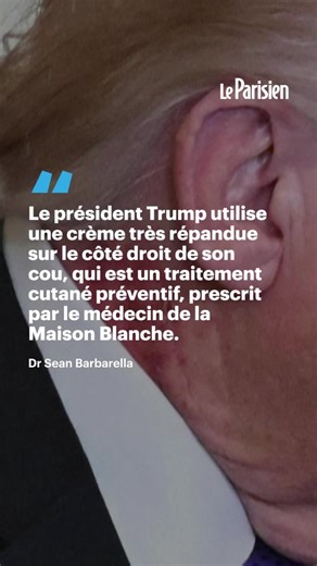Alors que des rumeurs circulent déjà sur sa santé depuis des mois, Donald Trump est apparu ce lundi avec une plaque rougeâtre assez étendue et bien visible dans le cou. Les théories vont alors bon train... Mais son médecin assure que ce « rash » est lié à l'application d'un traitement cutané préventif.