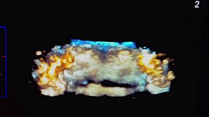 3d US Spine 2