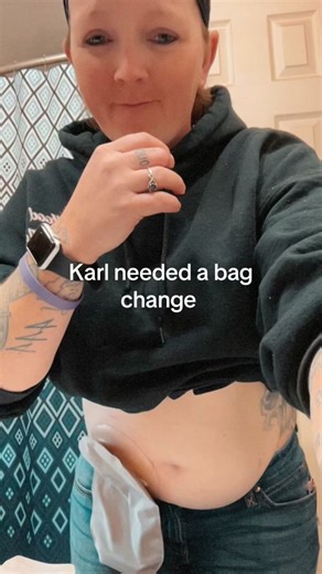 Ostomy Bag Change: My Routine and Tips