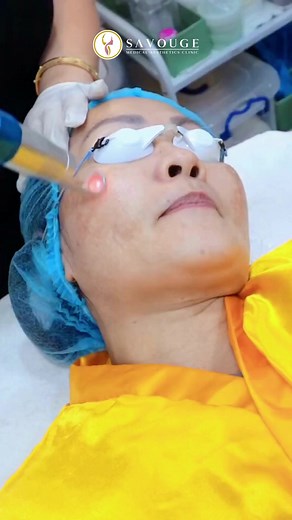 14K views · 76 reactions | Do you notice those brown patches on your...