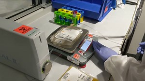 Plasma showing promising results in slowing Parkinson's and MS