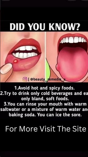 PAINFUL mouth ulcer? 😭 Do THIS immediately!