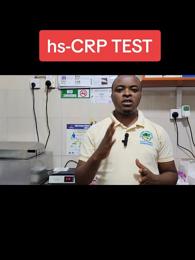 hs-CRP Test: High-Sensitivity CRP and Heart Risk Explained
