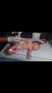 Watch this educational NICU video to learn how to insert an IV line (intravenous cannula) in a newborn baby with proper technique and gentle care. This step-by-step guide is designed for NICU nurses, pediatric residents, and neonatal care students to understand the safe and effective method of IV insertion in neonates. 👶💉 Learn about: Preparation and aseptic precautions Vein selection in newborns Step-by-step IV cannulation procedure Securing the IV line and preventing complications NICU best