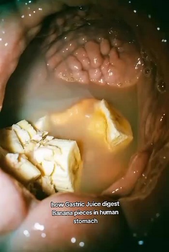 How Gastric Juice Digests Banana in the Stomach