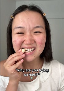 Healing my skin took time, patience, and a lot of change… but it was always for her 🤍✨ #acnejourney #acneskincare #hormonalacne #acnetreatment #clearskin
