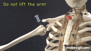 Humeral EZ-IO insertion, official method on Make a GIF